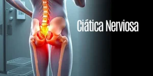 ciatica nerviosa causas sintomas y tratamientos efectivos copia